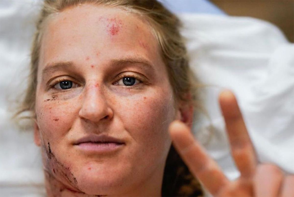 Veteran Climber Survives Fall From Yosemite's El Capitan With Help From 'Free Solo' Star