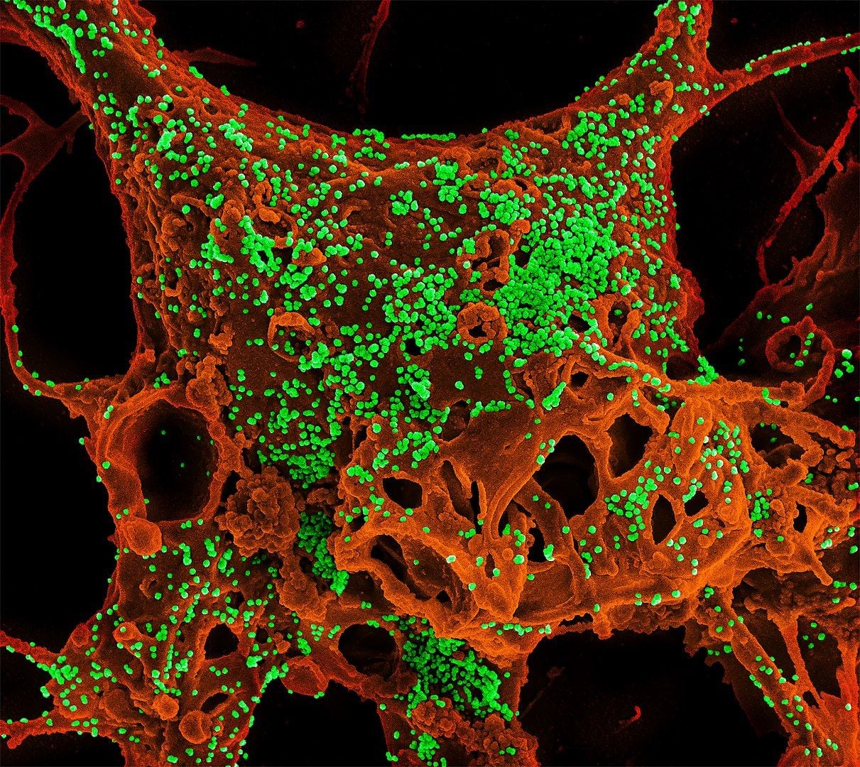 Costa Mesa Says 'No' To Coronavirus Patients, Objecting To Local Quarantine Facility