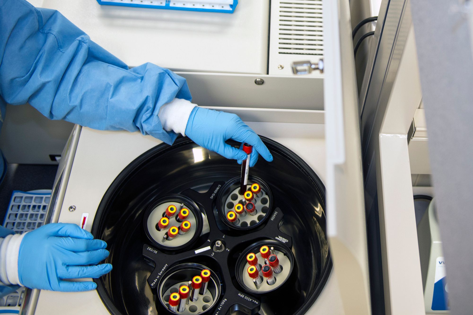 UCSF Begins Using Convalescent Plasma Therapy To Treat COVID-19 Patients