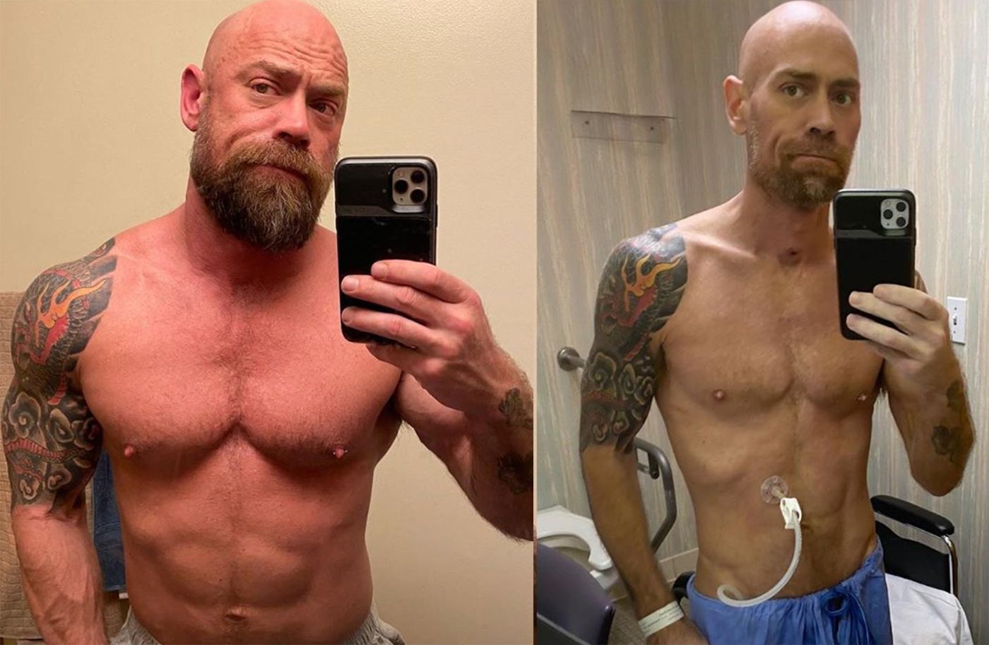 San Francisco Nurse Shares Photos After Eight Weeks In Hospital With COVID-19