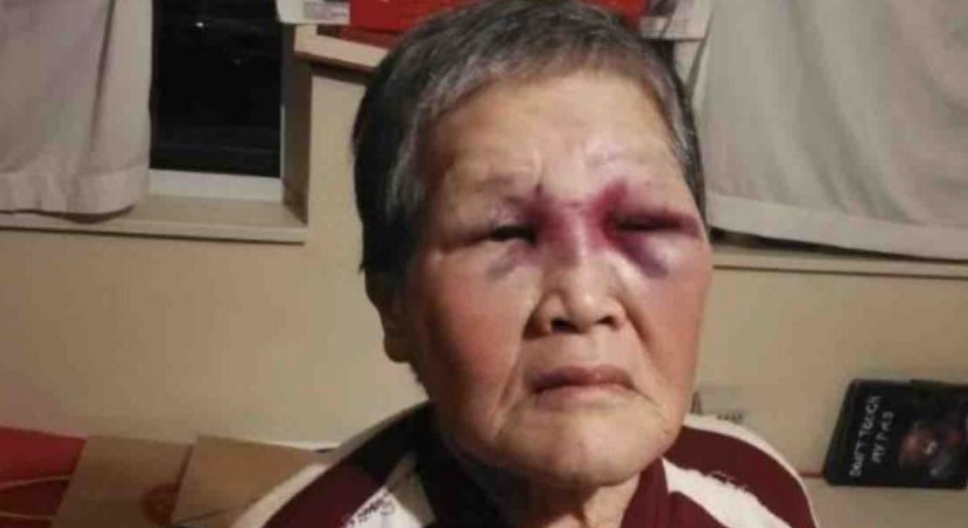 Elderly Asian Woman Says She Will Donate Crowdfunding Windfall Back to the Community to Fight Racism