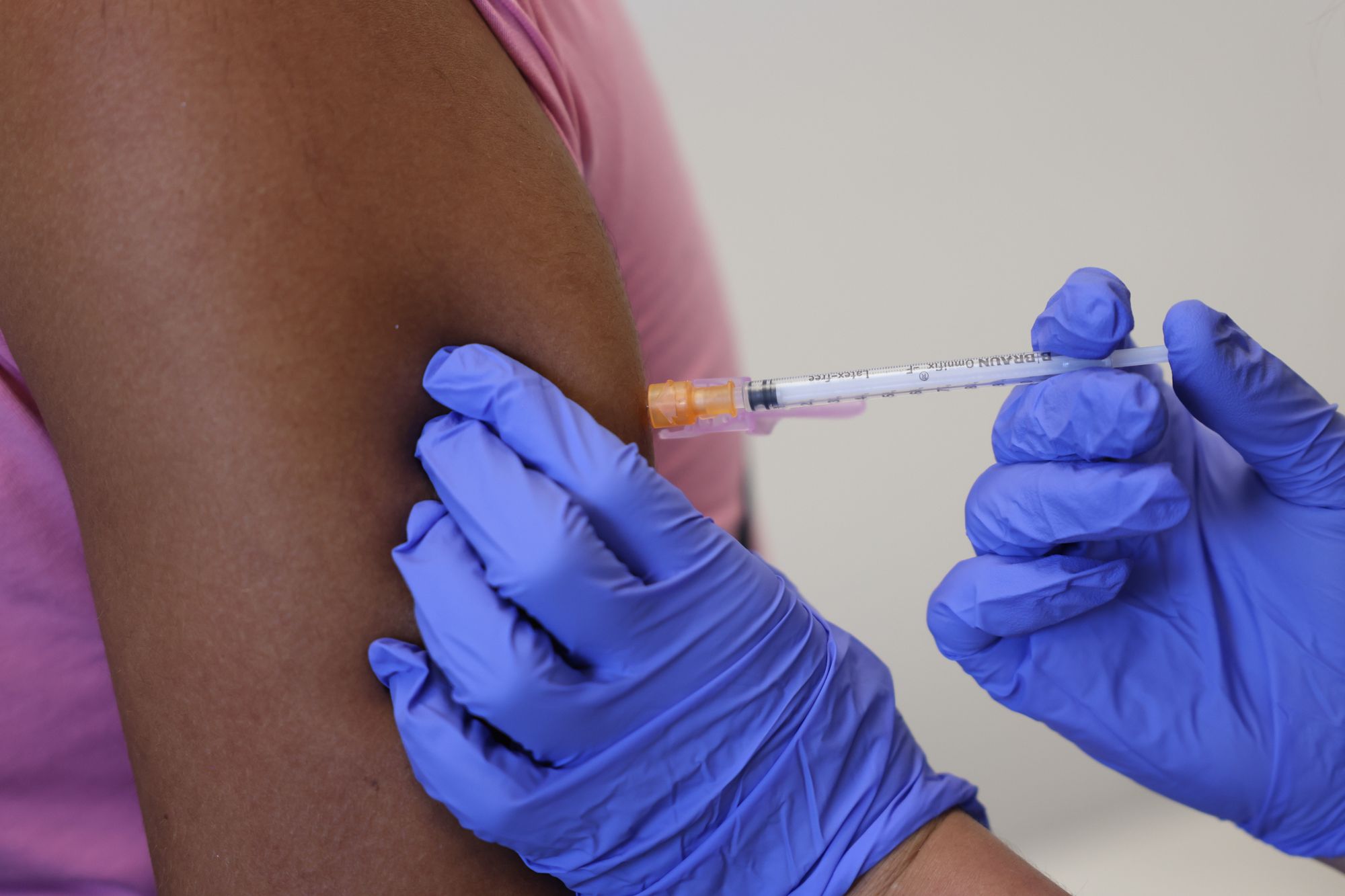 SF to Receive 1,600 More Monkeypox Vaccine Units; Clinics Will Switch to Intradermal Injection Technique