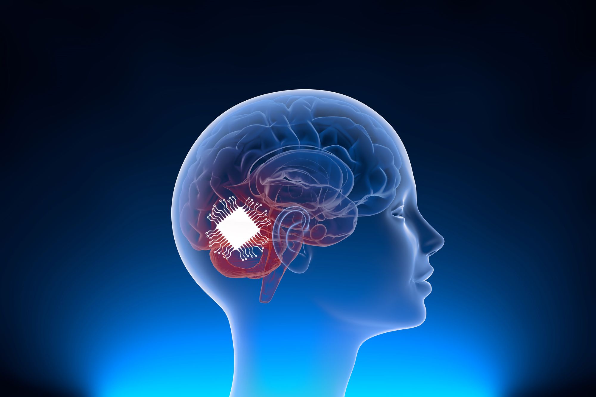 Elon Musk Claims the First Human Subject Has Gotten a Neuralink Implant In Their Brain