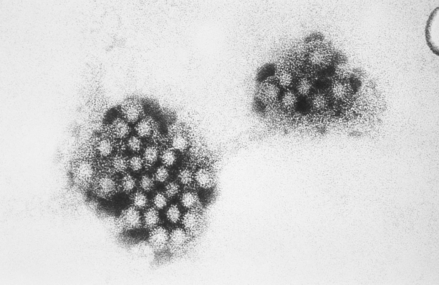 Norovirus Cases on the Rise Across the Country as Holiday Travels Wrap Up