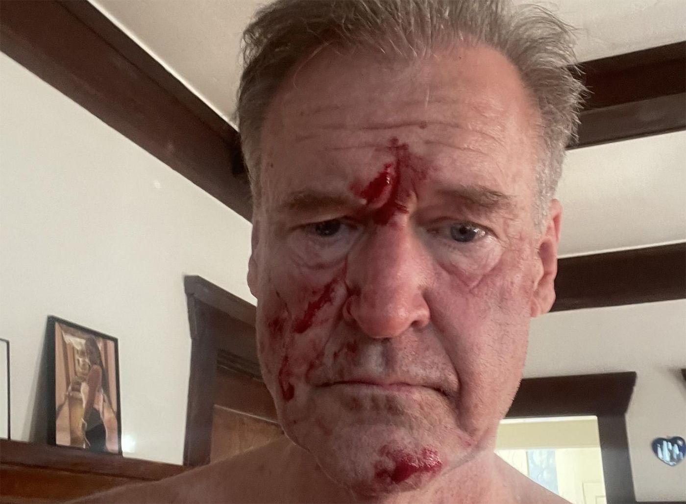 Former KTVU Anchor Frank Somerville Arrested Again In Oakland, Says It Stemmed From Fight With Daughter