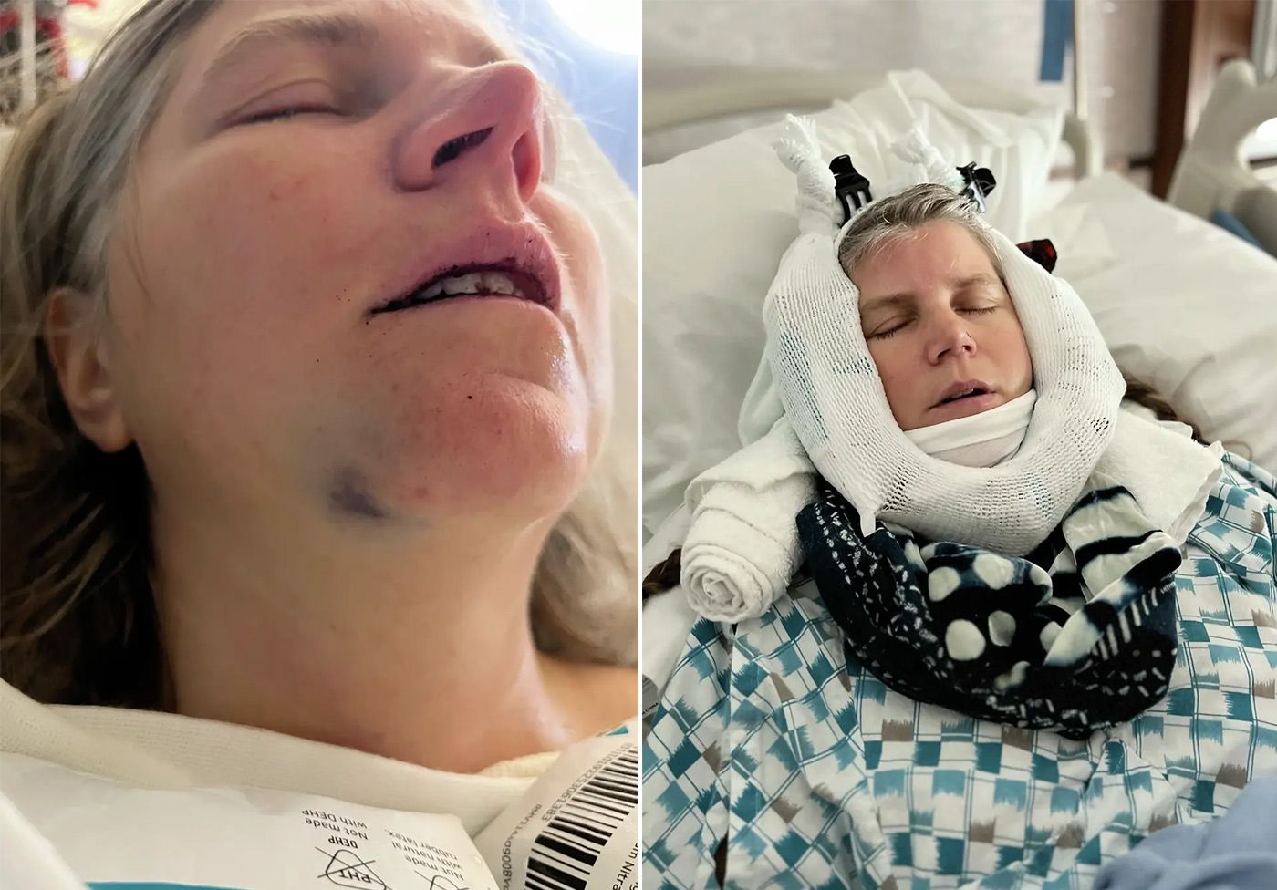 APEC Protester Seen Being Punched By Volunteer Files Suit, Suspect Seeks Mental Health Diversion